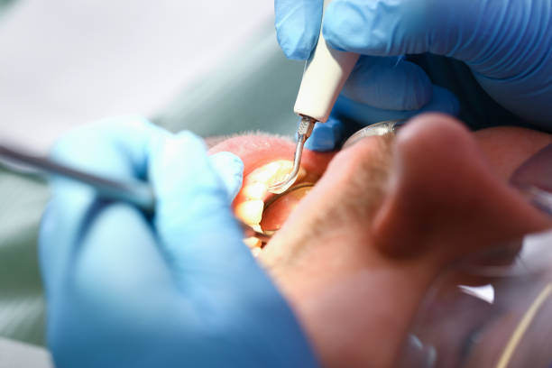 Best Mobile Emergency Dentist in Santa Cruz, CA