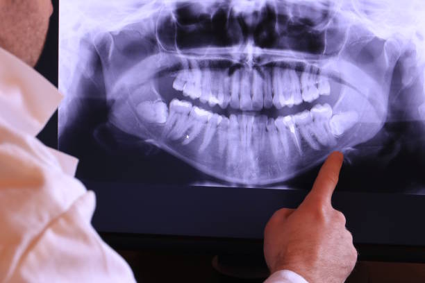 Best Emergency Root Canal Treatment in Santa Cruz, CA