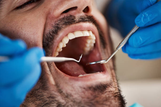 Best Emergency Dentist for Knocked-Out Tooth in Santa Cruz, CA